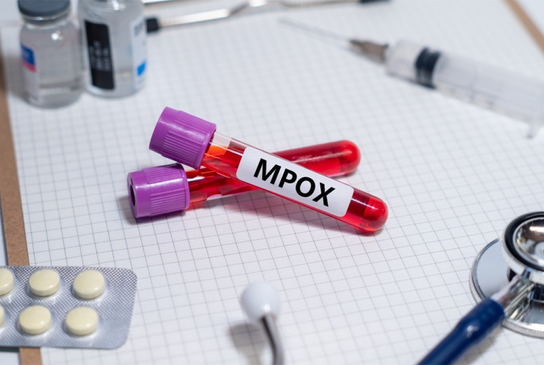 Mpox Clade 1B Hits India: Government’s Response and Preparedness